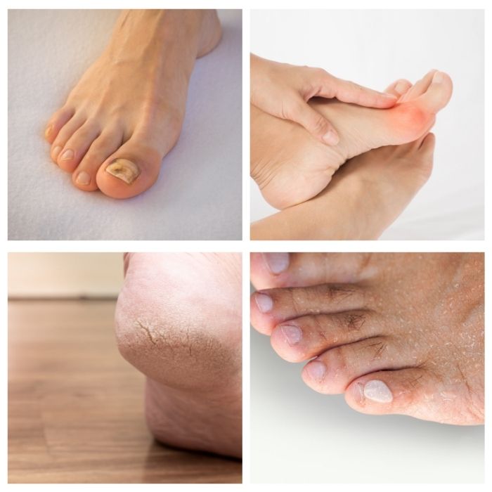 in home podiatry